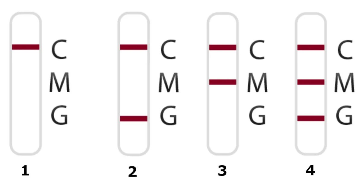Что означает три полоски. Экспресс тест на ковид 1 полоска. Результаты экспресс теста на ковид расшифровка. Тест на ковид с полосками расшифровка. Результат экспресс теста на ковид полоски расшифровка.