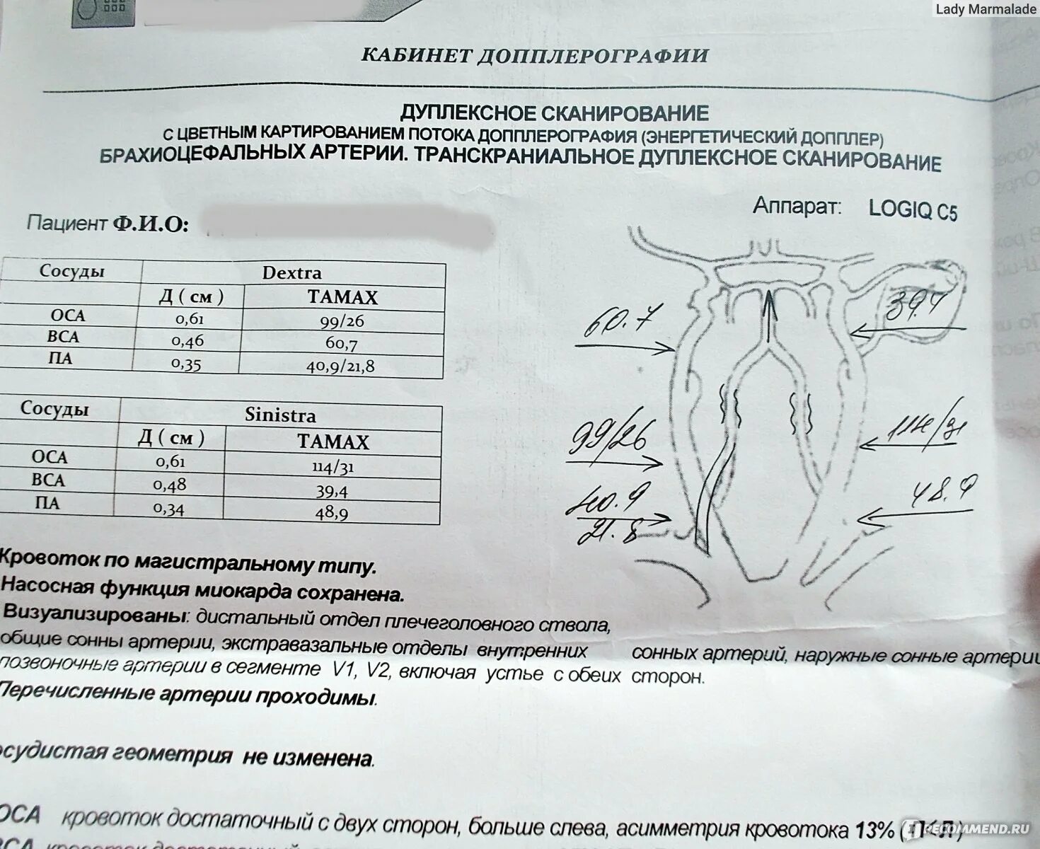 Что такое уздг. Ультразвуковое исследование брахиоцефальных сосудов норма. Бца УЗИ сосудов шеи расшифровка. УЗИ брахиоцефальных артерий расшифровка норма. УЗИ расшифровка допплерография брахиоцефальных артерий.