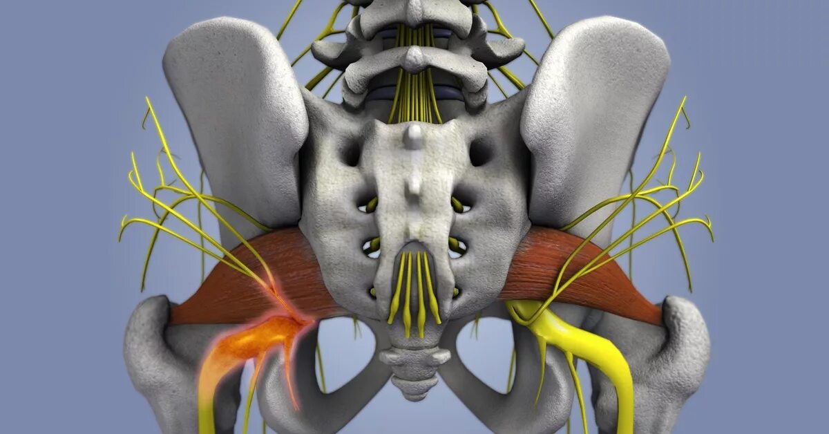Ишиас и синдром грушевидной мышцы. Седалищный нерв грушевидная анатомия. Иннервация седалищного нерва анатомия. Иннервация тазобедренного сустава. Зажим в пояснице