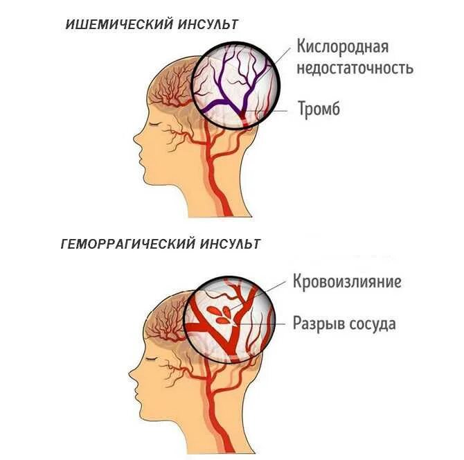 В голове какие то звуки
