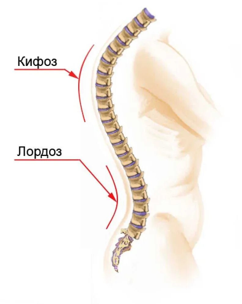 Лордоз грудного отдела кифоз поясничного. Лордоз шейного отдела отдела. Кифоз лордоз грудного отдела позвоночника. Позвоночник человека лордоз кифоз. Изгиб позвоночника 6