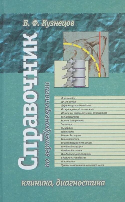Справочник кузнецова. Книги по вертебрологии. Книги по вертеброневрологии. Кузнецов Вертеброневрология. Веселовский практическая Вертеброневрология.