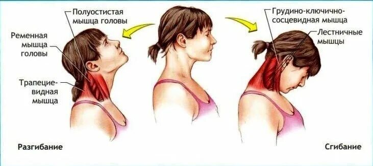 Спазм мышц шеи: как снять, что делать, если свело шею, какие обезболивающие табл