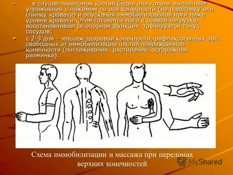 переломы верхних конечностей. массаж ног после травмы. массаж при переломе запястья. массаж при переломе костей конечностей. массаж голеностопного сустава.