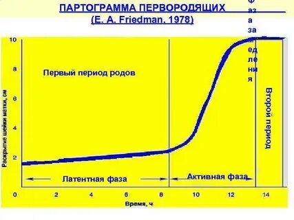 Партограмма