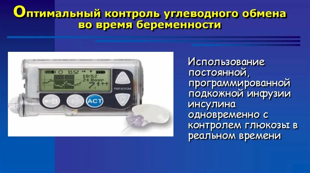 Постоянный непрерывный контроль. Контроль углеводного обмена. Оптимальный контроль. Мониторинг углеводного обмена. Непрерывный мониторинг Глюкозы.