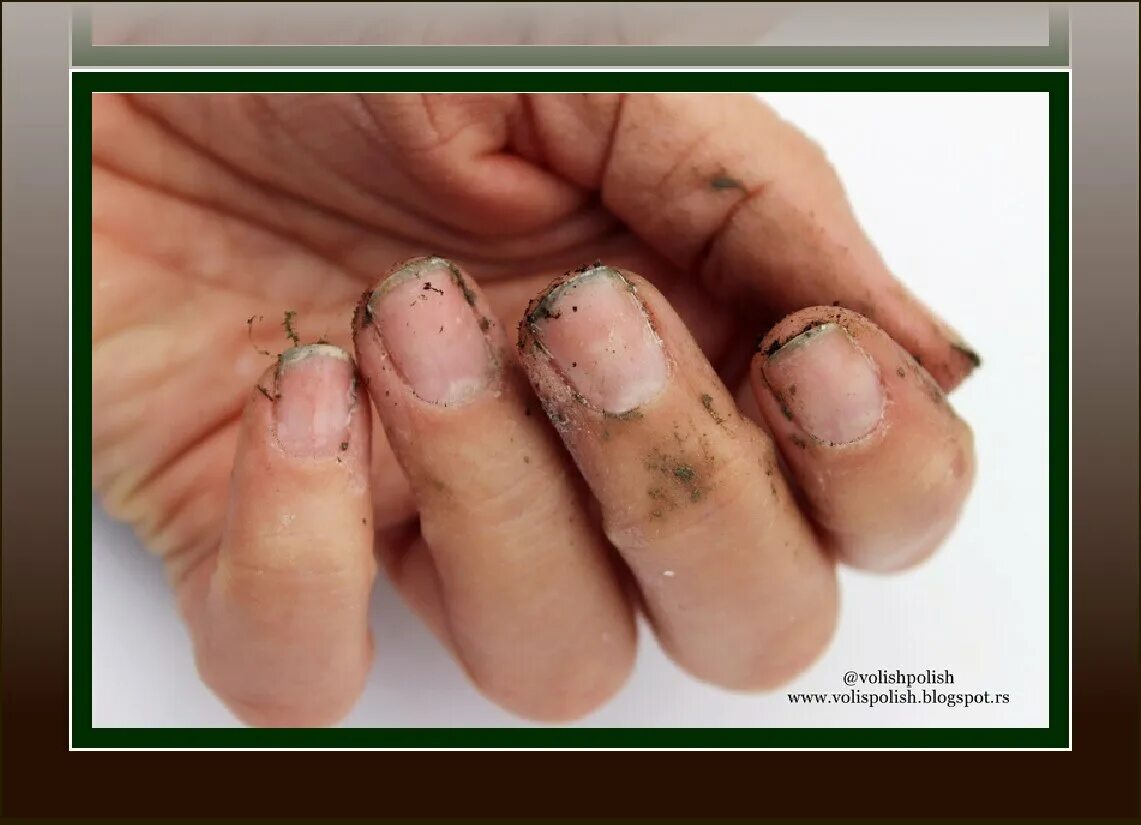 Смешные ногти. Ногти червяки. Маникюр с насекомыми. Маникюр с букашками. Анкилостома микроскоп.