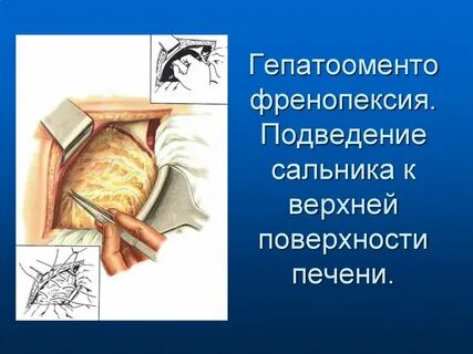 И операции на органах брюшной