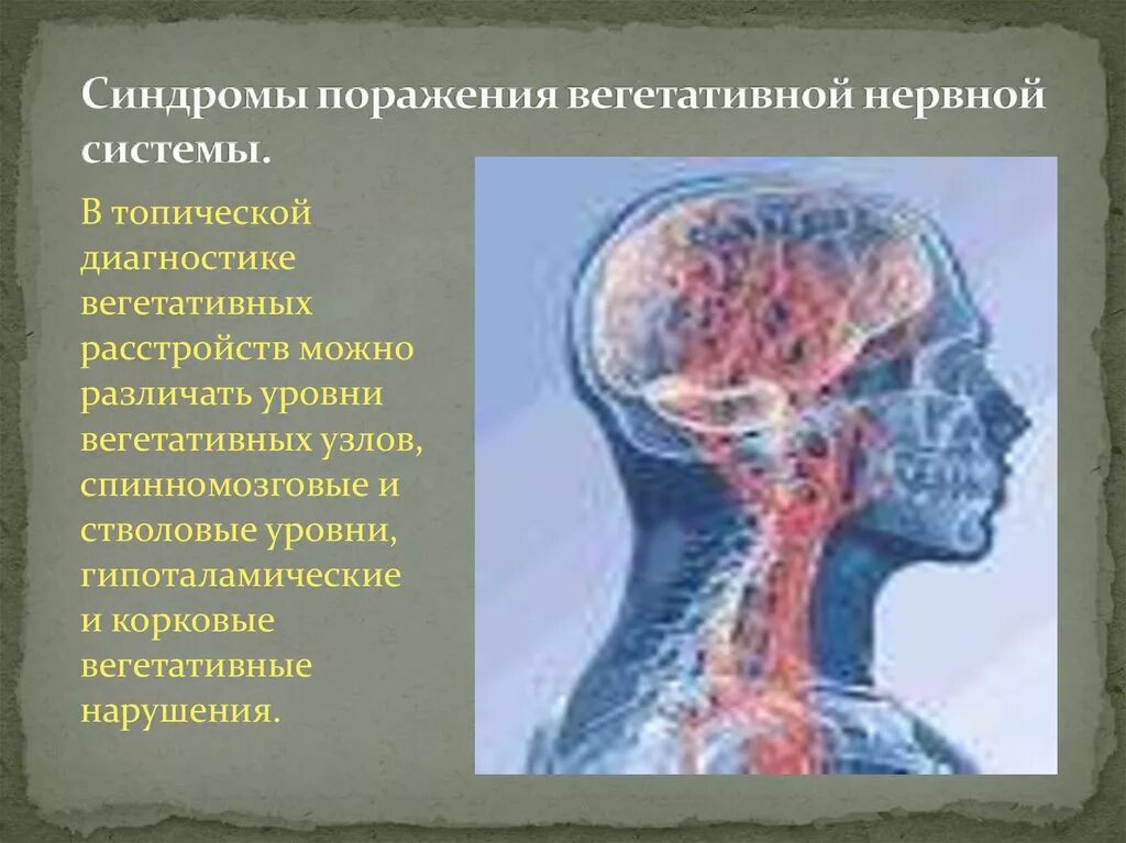 Расстройство вегетативной нервной системы у человека приводит. Вегетативная нервная система симптомы. Нарушение вегетативной системы. Синдромы поражения ВНС. Поражение вегетативной нервной системы.