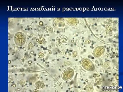 Цист лямблии