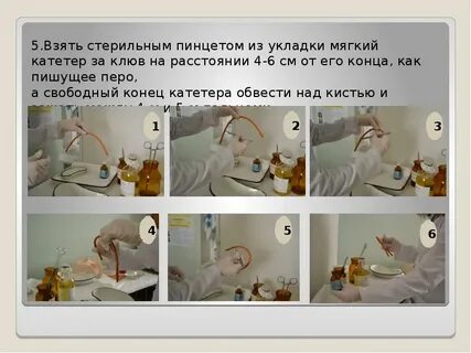 Катетер для выведения мочи
