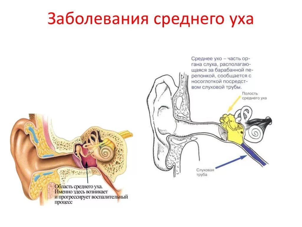 Повреждения органа слуха