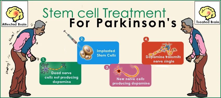 Болезнь паркинсона неврология лекция. Parkinson's disease medical treatment. Известные люди с болезнью паркинсона. Подходы к лечению болезни паркинсона. Сытин паркинсон.
