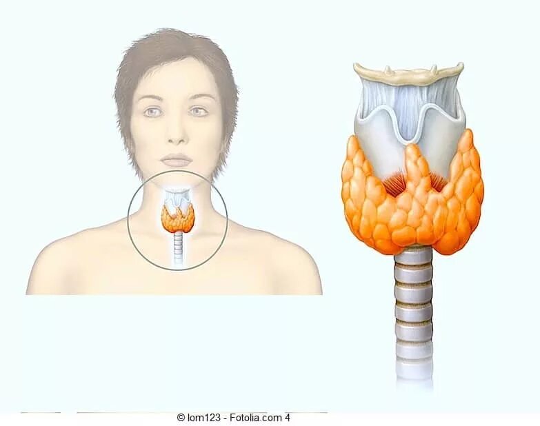 Лечение эутиреоза щитовидной железы у женщин. Аутоиммунный тиреоидит эутиреоз. Аутоиммунный тиреоидит щитовидной железы симптомы. Аутоиммунный тиреотоксикоз щитовидной.