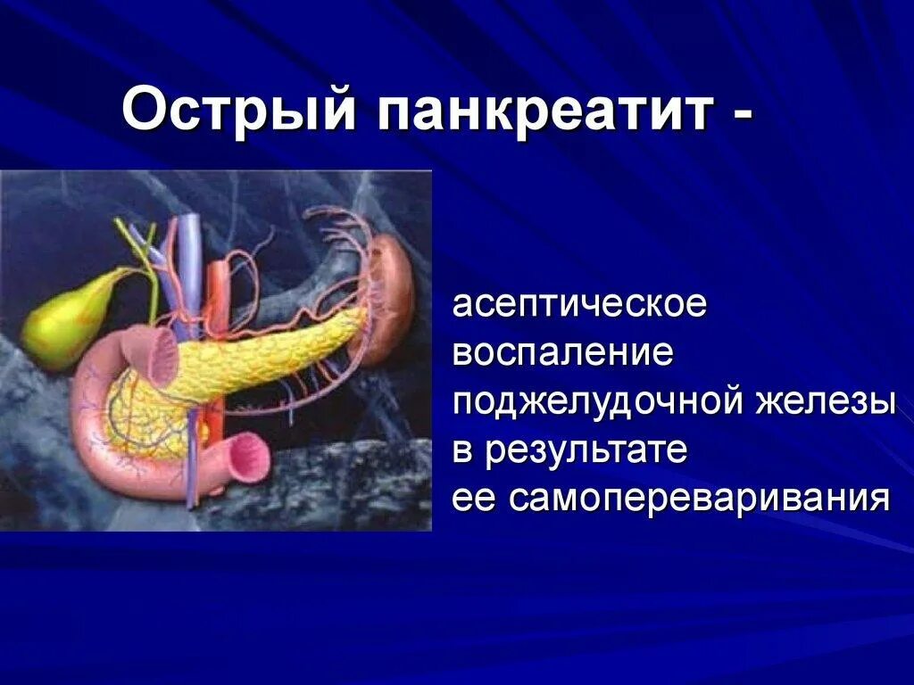 Заболев поджелудочной железы. Острый панкреатит острый. что такое панкреатит поджелудочной. самопереваривание поджелудочной железы.