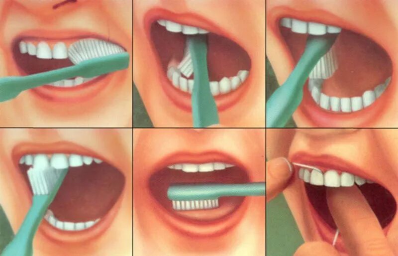 Когда лучше чистить зубы. Гигиена зубов. Как чистить зубы. Гигиена ротовой полости.