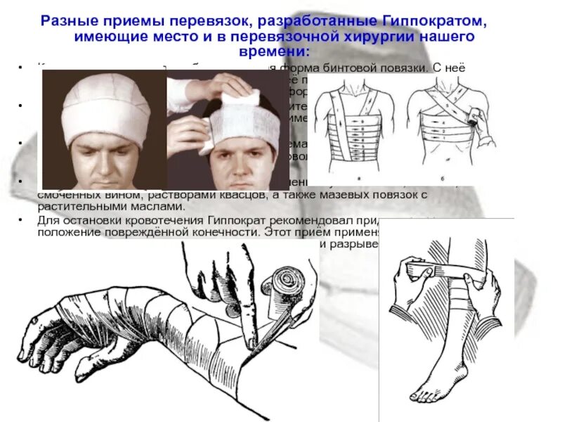 Алгоритм перевязки