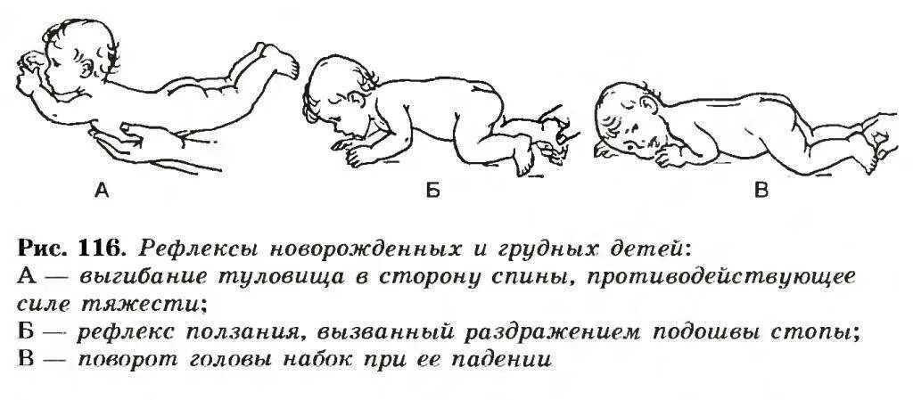 Врожденные рефлексы новорожденных. Безусловные рефлексы у детей 1 года жизни. Рефлексы при ДЦП У детей до года. Рефлексы новорожденных с 1 месяца у новорожденных. Безусловные рефлексы у ребенка до 1 года.