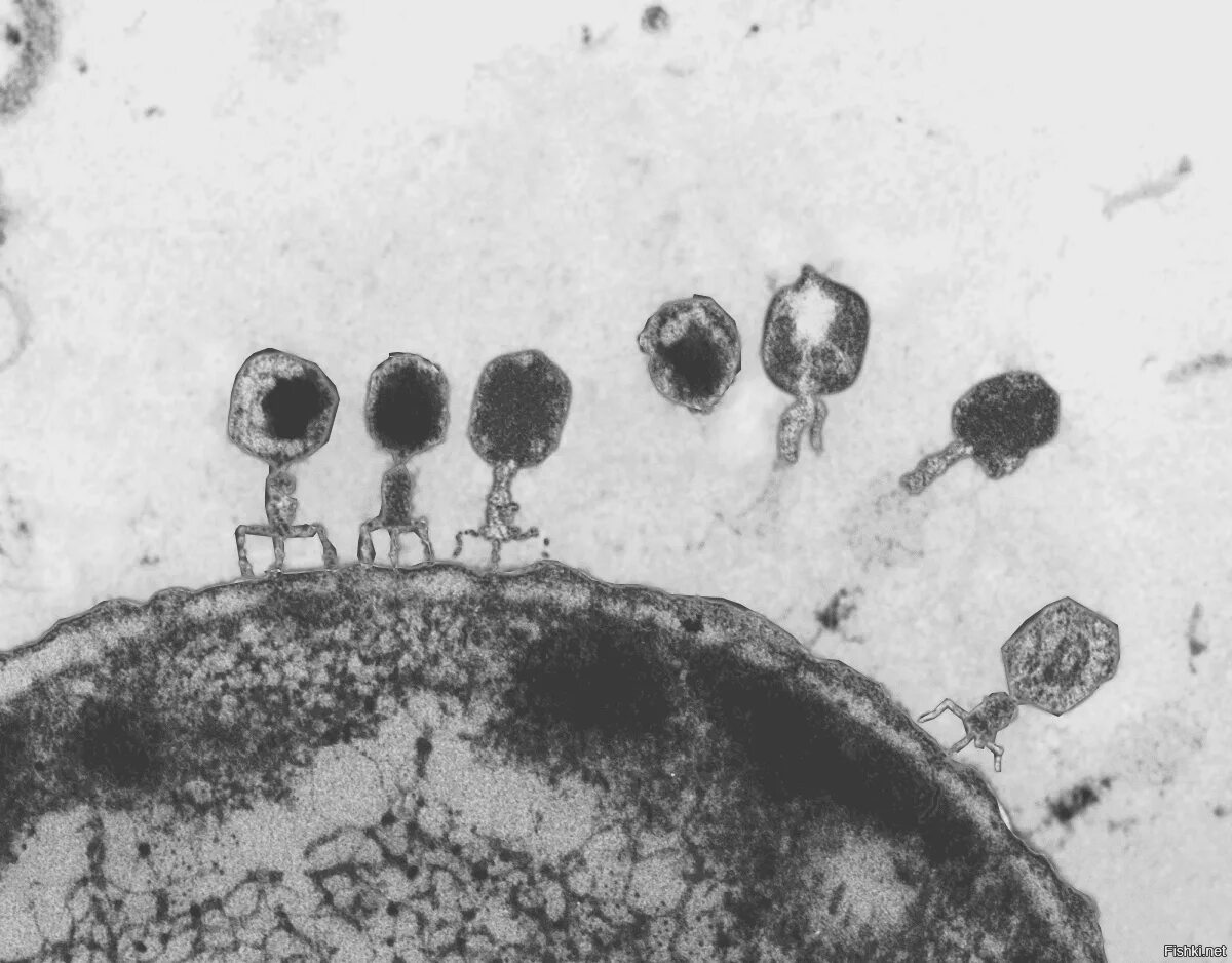 Адсорбция вируса. Вирус бактериофаг под микроскопом. Вирус бактериофаг микроскоп. Холерный бактериофаг. Бактериофаг на бактерии электронный микроскоп.