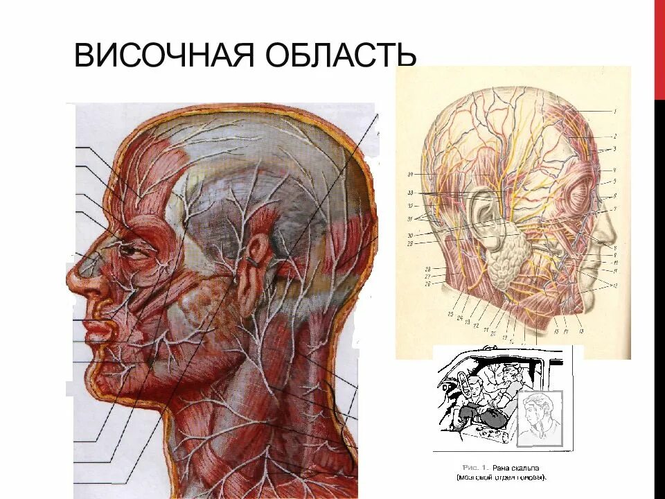 Затылок область. Послойная топография височной области. Височная область топографическая анатомия сосуды. Слои височной области топографическая анатомия. Слои височной области головы на топографическая анатомия.