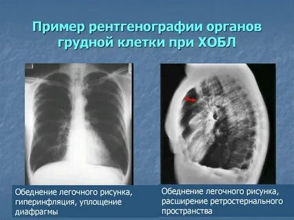 Орган r 68.8