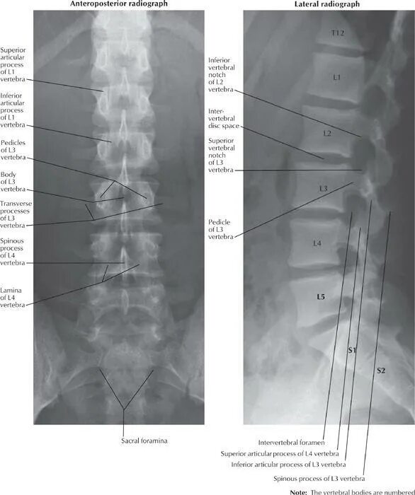 Рентгенография позвоночника в 2 х проекциях. Рентгеноанатомия пояснично-крестцового отдела позвоночника. Грудной отдел позвоночника рентген норма. Рентгеноанатомия поясничного отдела позвоночника. Крестцовый отдел позвоночника рентген анатомия.