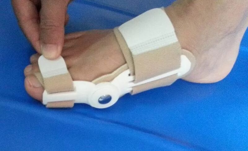 Hallux valgus шина. Фиксатор вальгусной деформации большого пальца стопы. Вальгус про фиксатор для большого пальца. Вальгус деформация большого пальца стопы. Вальгусная операция реабилитация после операции