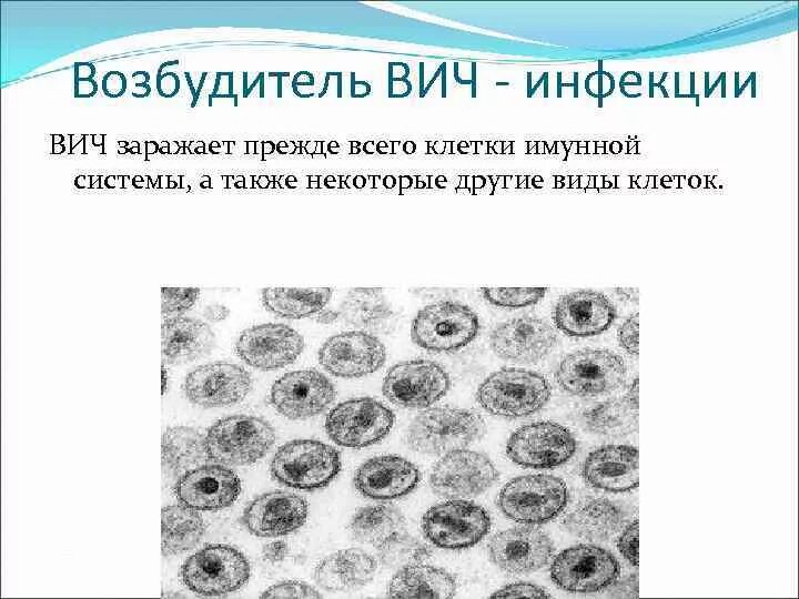 Возбудителем заболевания человека спида является вирус. Возбудитель вич инфекции. возбудитель вич инфе. вирус иммунодефицита человека возбудитель. вич инфекция особенности возбудителя.