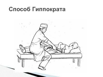 Вправление грыжи