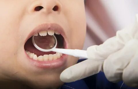 kids dental care