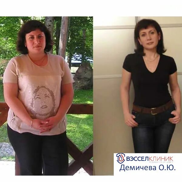 Похудение до и после. Похудение до и после фото. Похудела до и после.