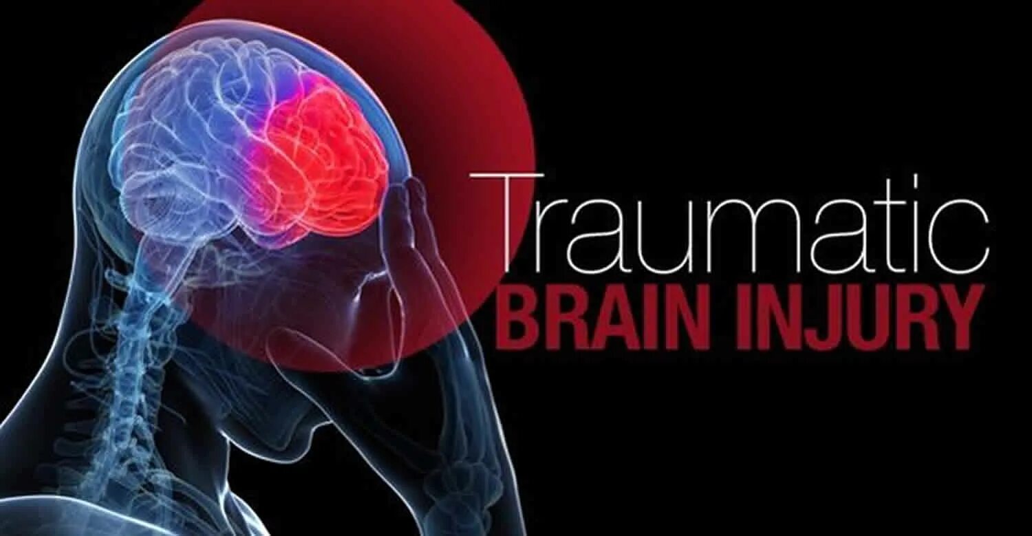 Повреждение головного мозга. Медицина мозг. Traumatic Brain injury Symptoms.