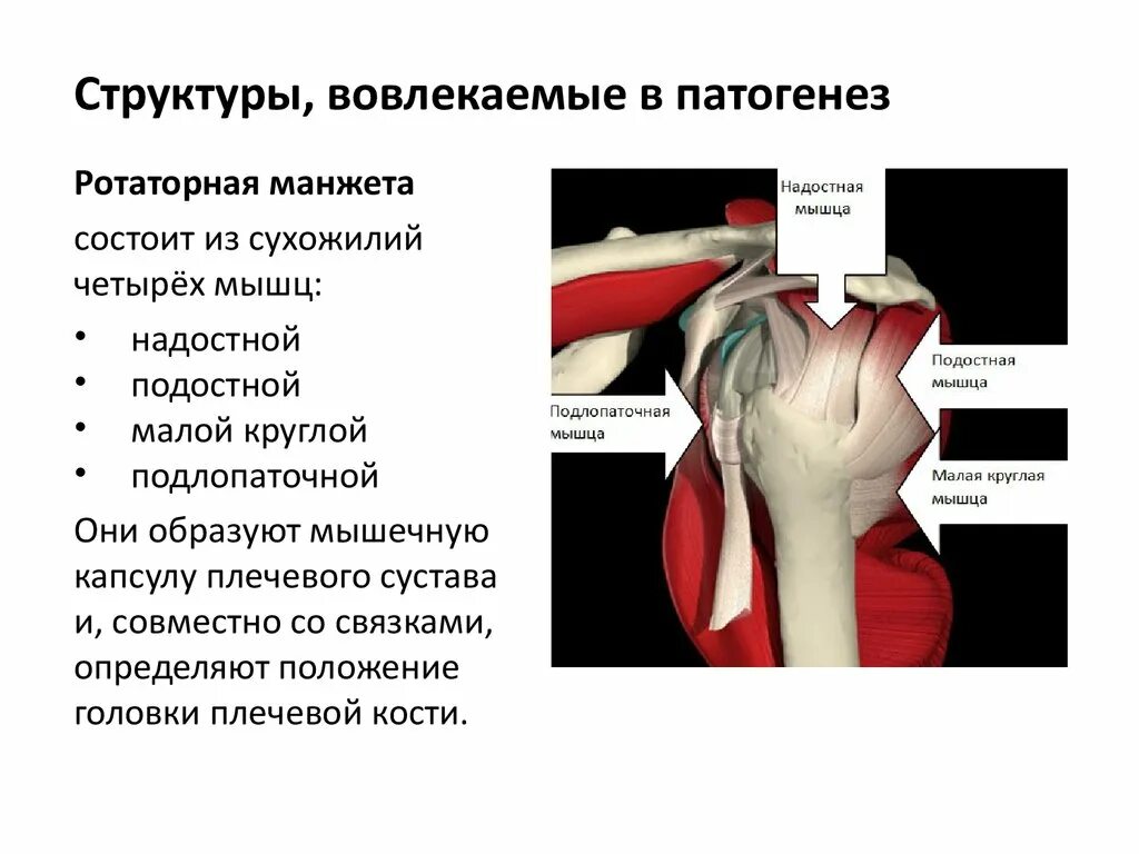 Повреждение сухожилия подлопаточной мышцы. Ротаторная манжета плечевого сустава надостная. Тендинопатия сухожилия плечевого сустава. Тендиноз сухожилия надостной мышцы мрт. Тендинит подостная мышца плечевого сустава.