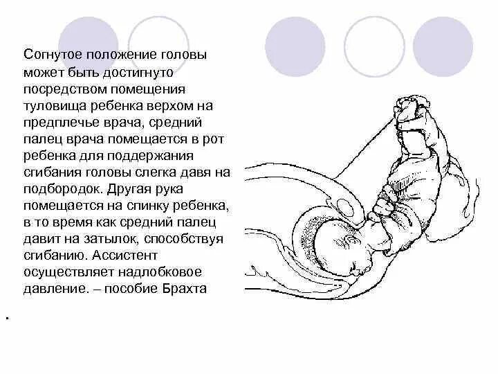 Во сколько недель ребенок переворачивается вниз головой. Ребенок в тазовом положении. гимнастика для беременных тазовое предлежание. тазовое предлежание плода упражнения.