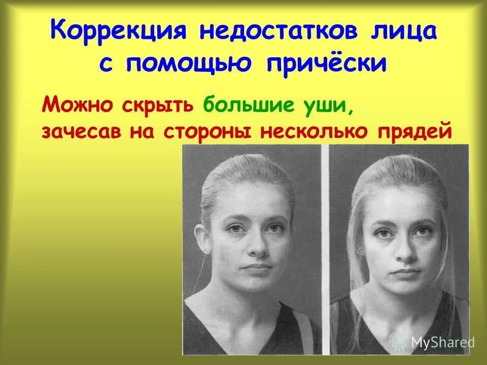 Уменьшение нижней челюсти. Мезиальный прикус прогения. Дефект лица как называется. Дефект лица как называется. Исправление асимметрии лица.