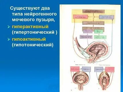 Нервный пузырь