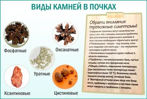 Камни в почках что можно есть