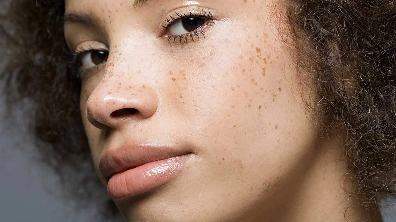 Freckles перевод. Loreal веснушки. Лентиго, хлоазма, веснушки. Краска для веснушек. Спрей для веснушек.