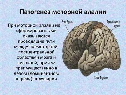Механизм сенсорной алалии