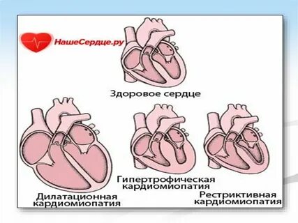Сердце на поражение текст