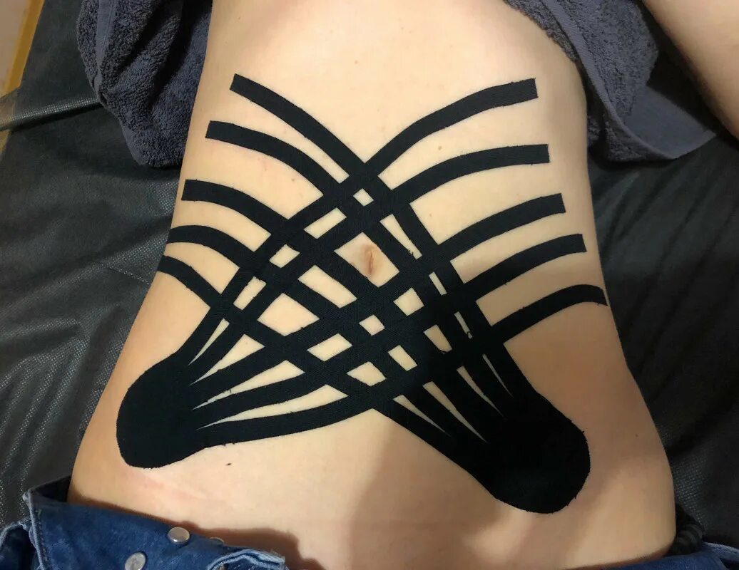 лимфодренаж боков тейпирование. тейпирование лимфа-тейп. тейпирование живота пупочная грыжа. лимфодренажный тейп на бедра. лимфодренажное тейпирование.