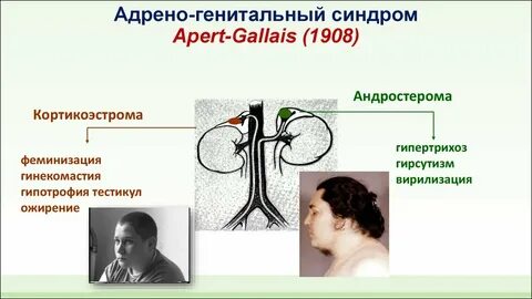 Адреногенитальный синдром у новорожденного