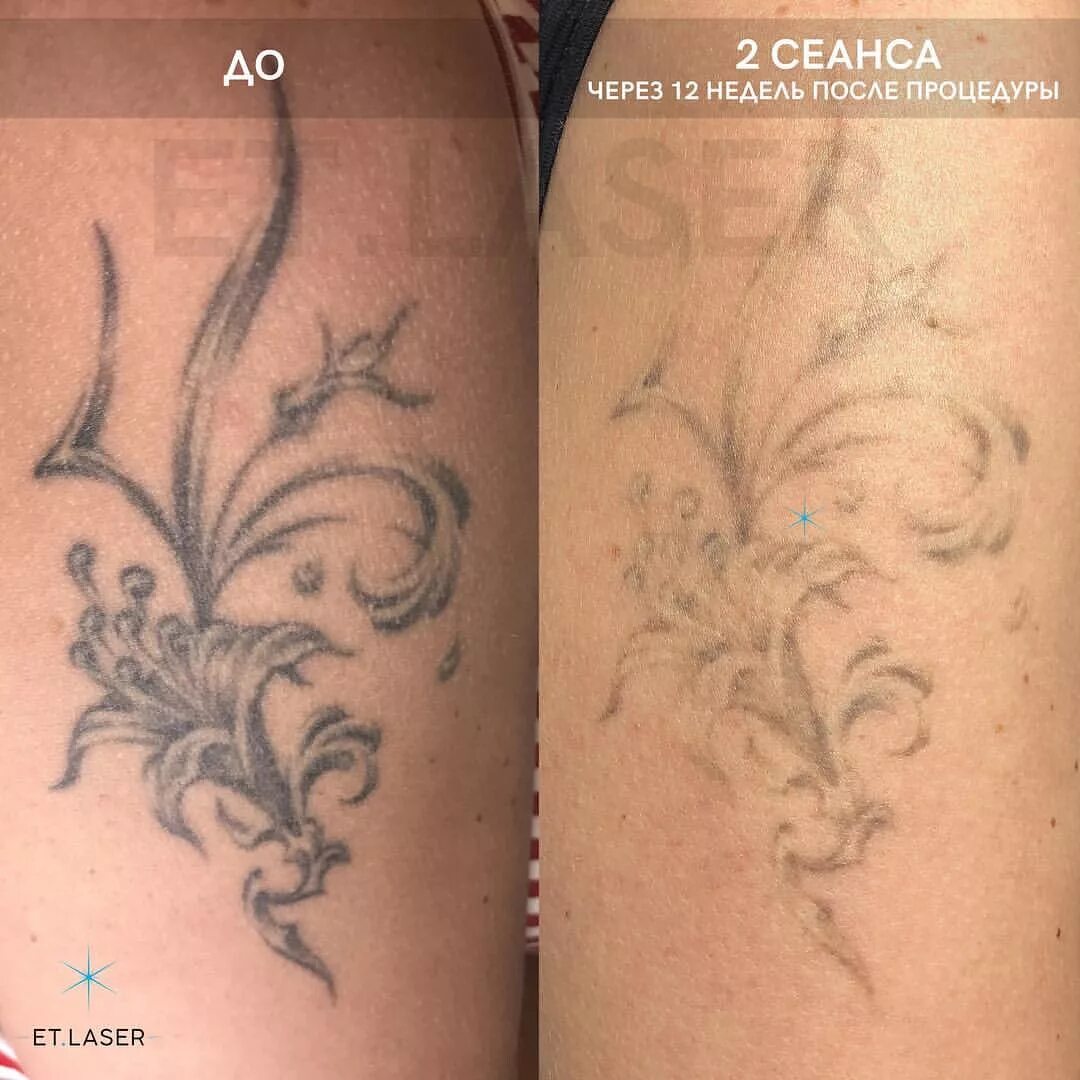 Тату набить алкоголь. Советы по заживлению татуировки. Тату алкоголь. Рекомендации перед и после тату. Сколько дней нельзя пить алкоголь после татуировки.