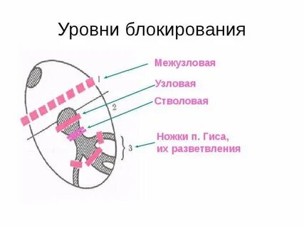 Блокирование 100