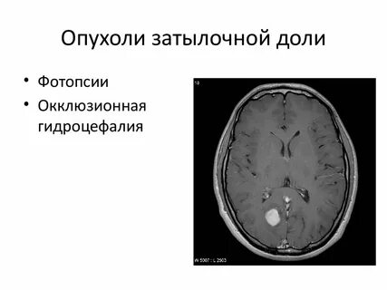 Объемное образование