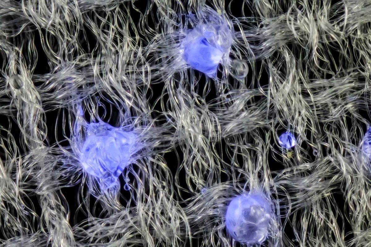 Волокно хлопчатника под микроскопом. Волокна асбеста под микроскопом. Коллагеновые волокна микроскопия. Хризотиловый асбест под микроскопом. Волокна коллагена под микроскопом.