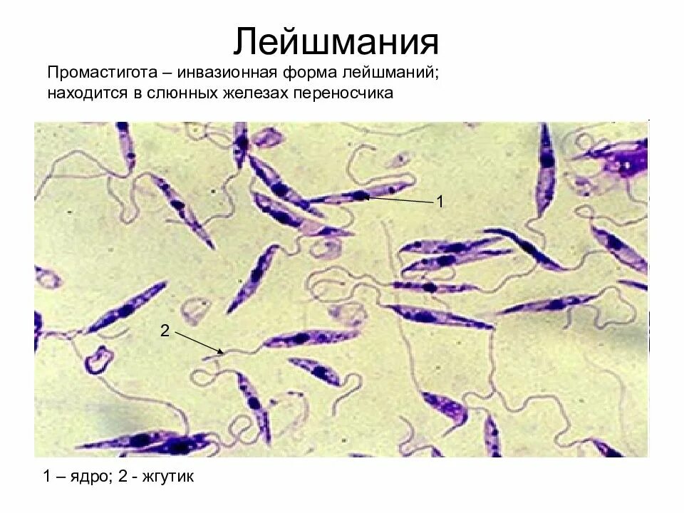Лейшмания формы. Лейшмании амастигота и промастигота. лейшмания препарат микроскоп.