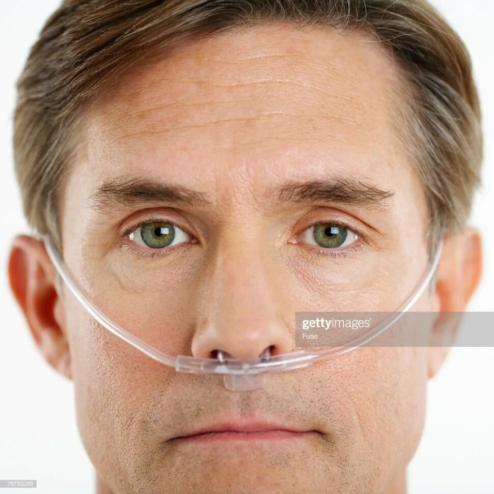 Облегчить дыхание носом. Nasal Oxygen Cannula. Носовая канюля. Кислородотерапия носовые канюли. Интерседжикал носовая канюля.