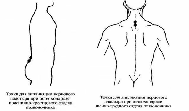 При остеохондрозе можно перцовый пластырь. Перцовый пластырь при остеохондрозе грудного отдела позвоночника. перцовый пластырь на шею при остеохондрозе. перцовый пластырь при хондрозе шейного. перцовый пластырь при шейном остеохондрозе как правильно клеить.