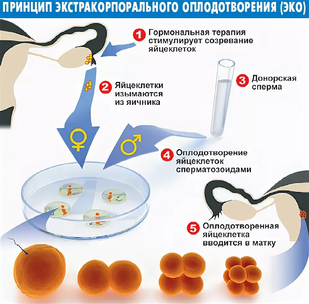 Схема экстракорпорального оплодотворения. Эко метод оплодотворения. Эко это искусственное оплодотворение. Искусственное оплодотворение этапы.